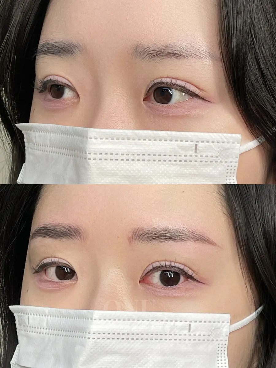 Client result 6