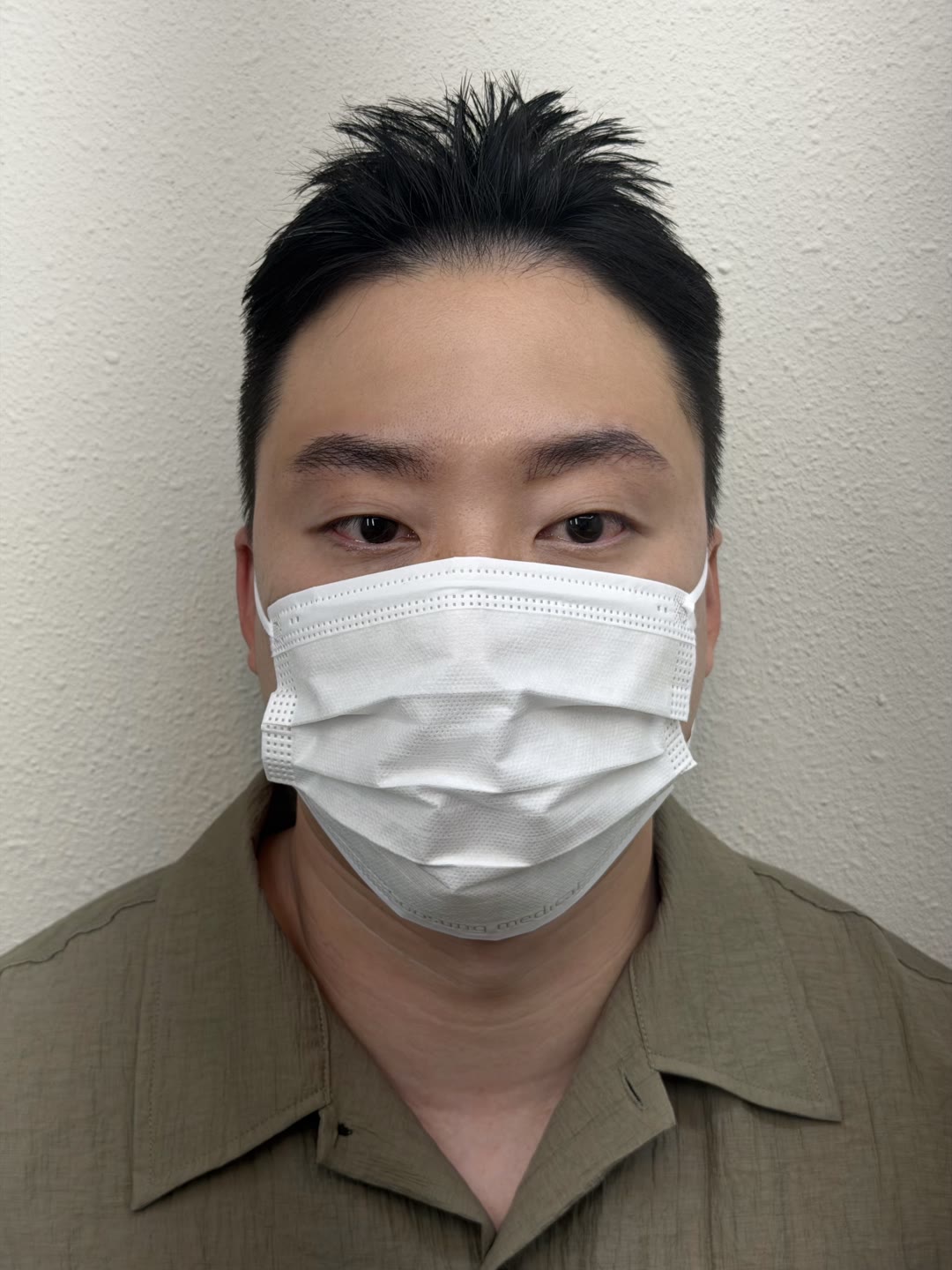 남성 고객 전체 인상 AFTER · 시술 후