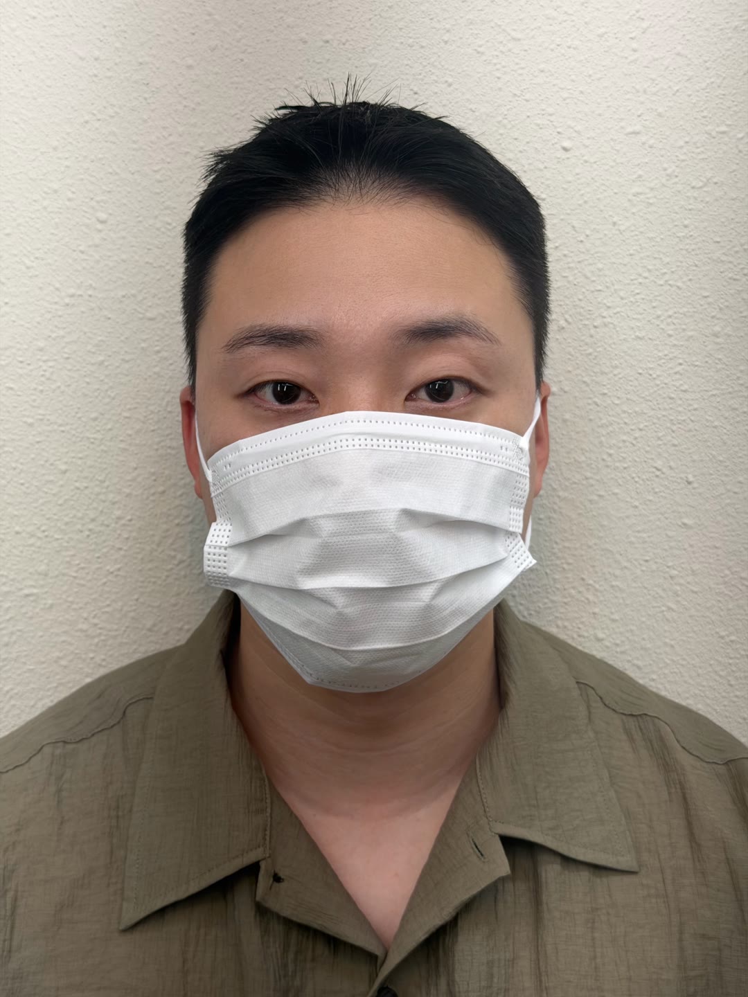 남성 고객 전체 인상 BEFORE · 시술 전